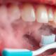 gingivitis has foul odor