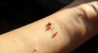 skin bacteria produce odor