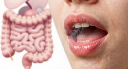 digestive health affects oral