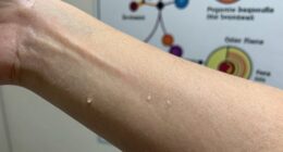 protein s role in odor