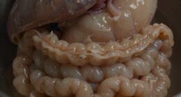 bloating fullness sluggishness