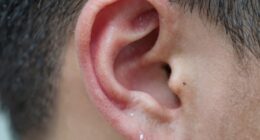 ear itch can be complex