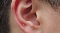 ears sensitivity to moisture