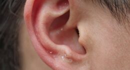 ears sensitivity to moisture