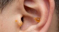 earwax protects and cleans