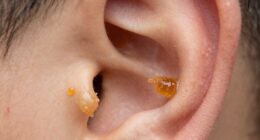 earwax protects and cleans