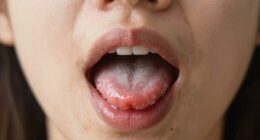 persistent oral odor investigation