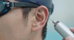 preventing swimmer s ear moisture