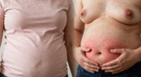 sensation of fullness versus inflammation