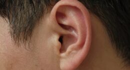 uncomfortable persistent ear sensation