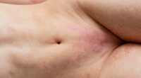 vaginal versus vulvar care