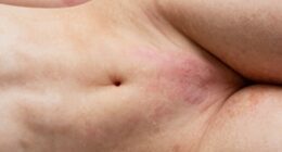 vaginal versus vulvar care