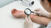 6 Signs Your Skin Needs Medical Attention, Stat