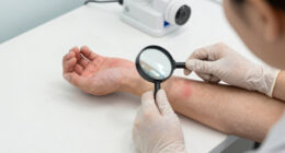 6 Signs Your Skin Needs Medical Attention, Stat