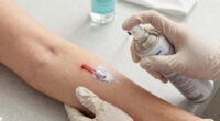 This spray-on powder can stop life-threatening bleeding in 1 second