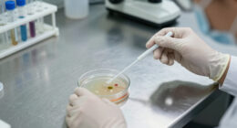 Candida Auris